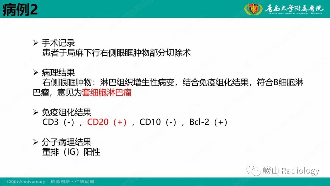 影像PPT - 【病例】Rosai-Dorfman病 & 套细胞淋巴瘤-28