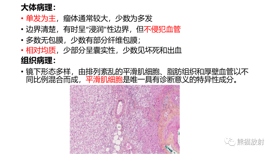 影像PPT - 【病例】肝血管平滑肌脂肪瘤 VS 含脂肝细胞肝癌-34