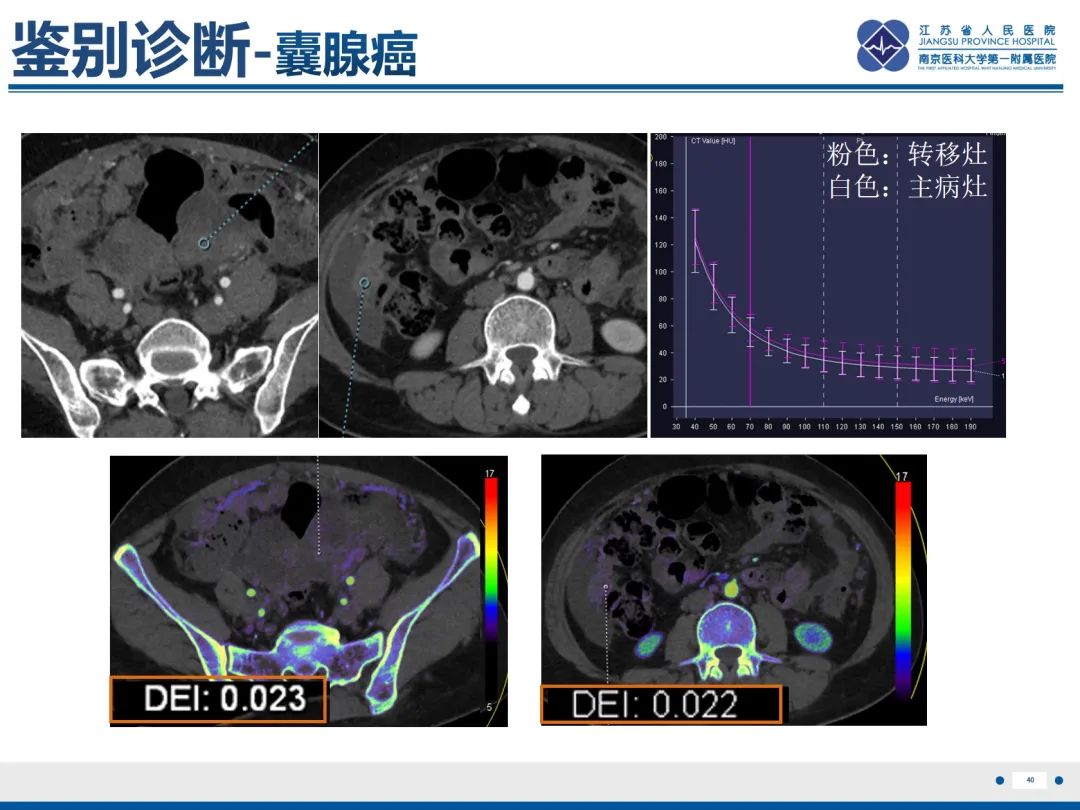 影像PPT - 【PPT】卵巢甲状腺肿合并畸胎瘤-41