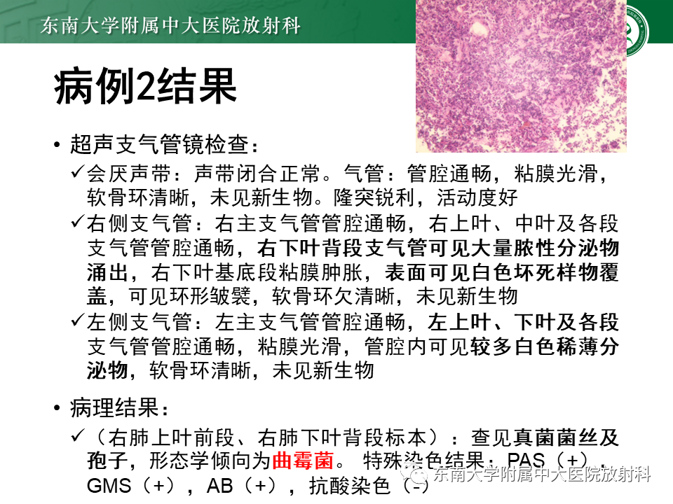 影像PPT - 【PPT】“反晕征”相关病变及鉴别-14