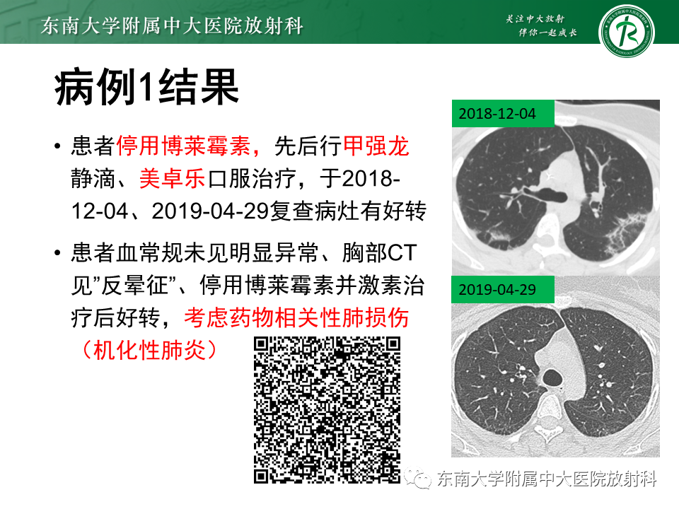 影像PPT - 【PPT】“反晕征”相关病变及鉴别-13