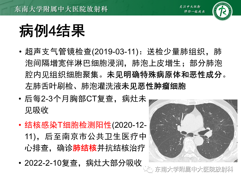 影像PPT - 【PPT】“反晕征”相关病变及鉴别-16