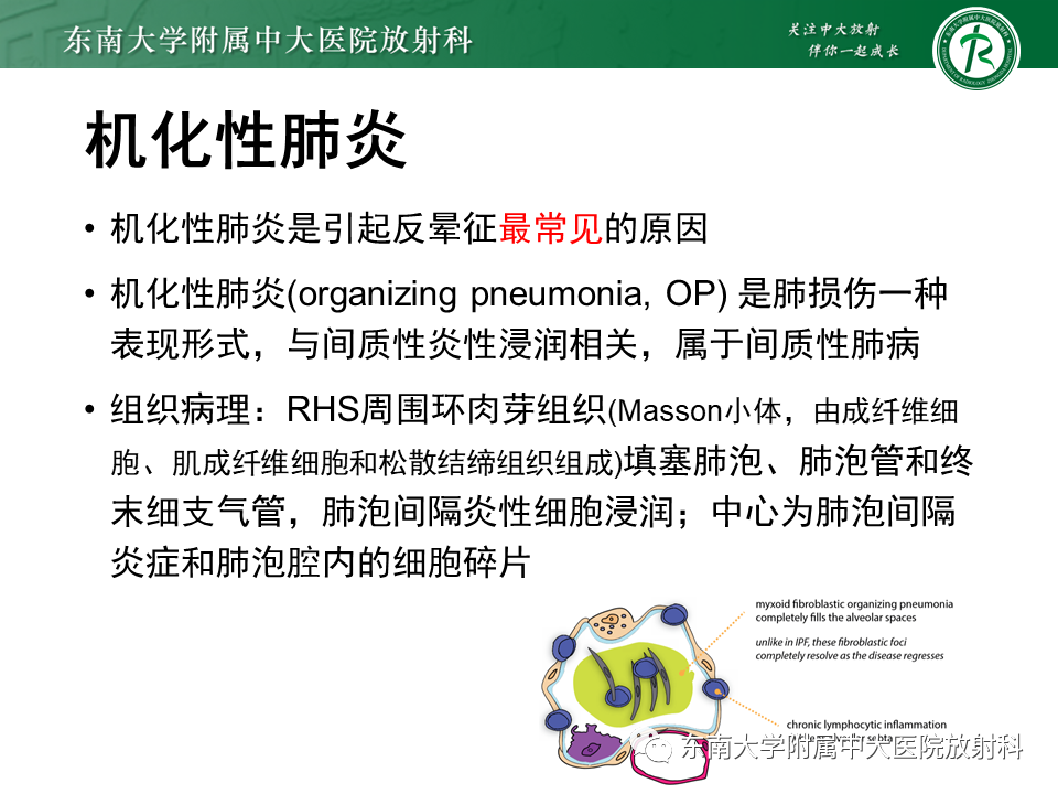 影像PPT - 【PPT】“反晕征”相关病变及鉴别-23