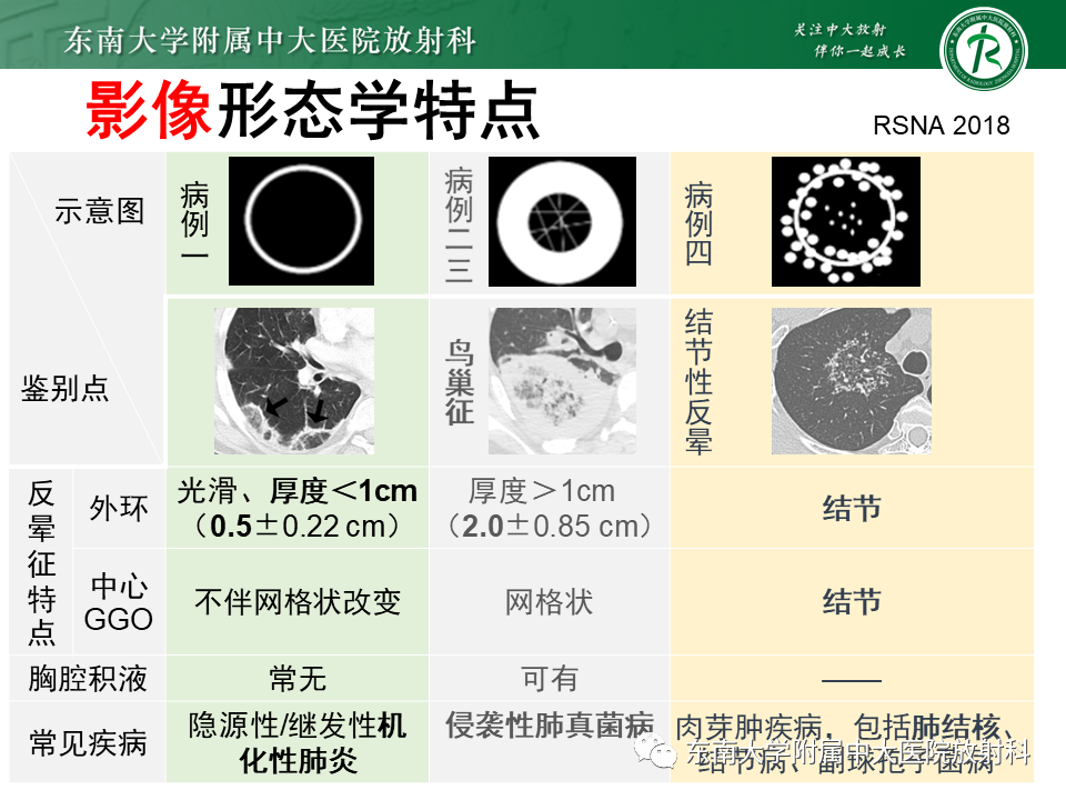 影像PPT - 【PPT】“反晕征”相关病变及鉴别-22