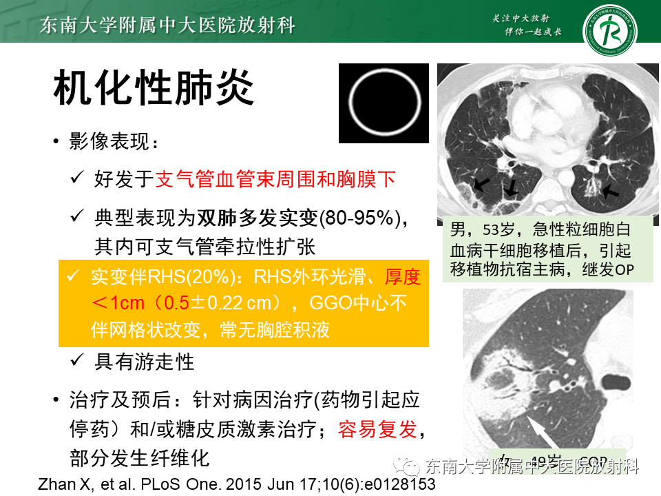 影像PPT - 【PPT】“反晕征”相关病变及鉴别-25