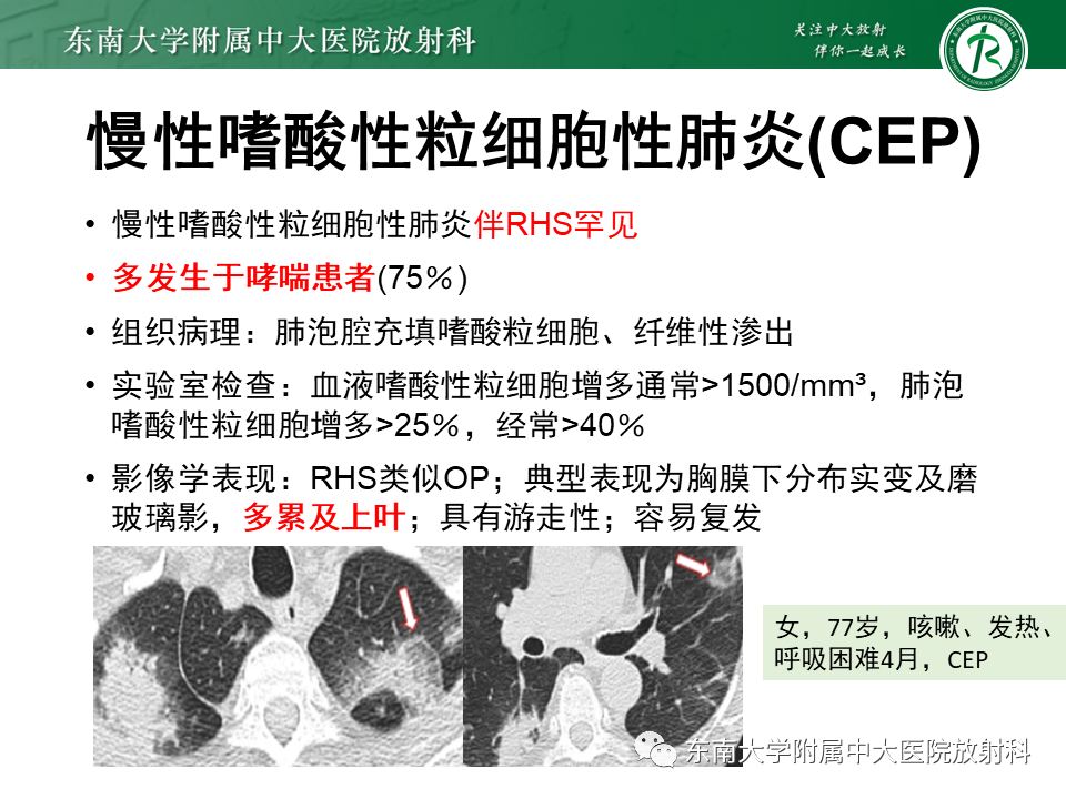 影像PPT - 【PPT】“反晕征”相关病变及鉴别-27