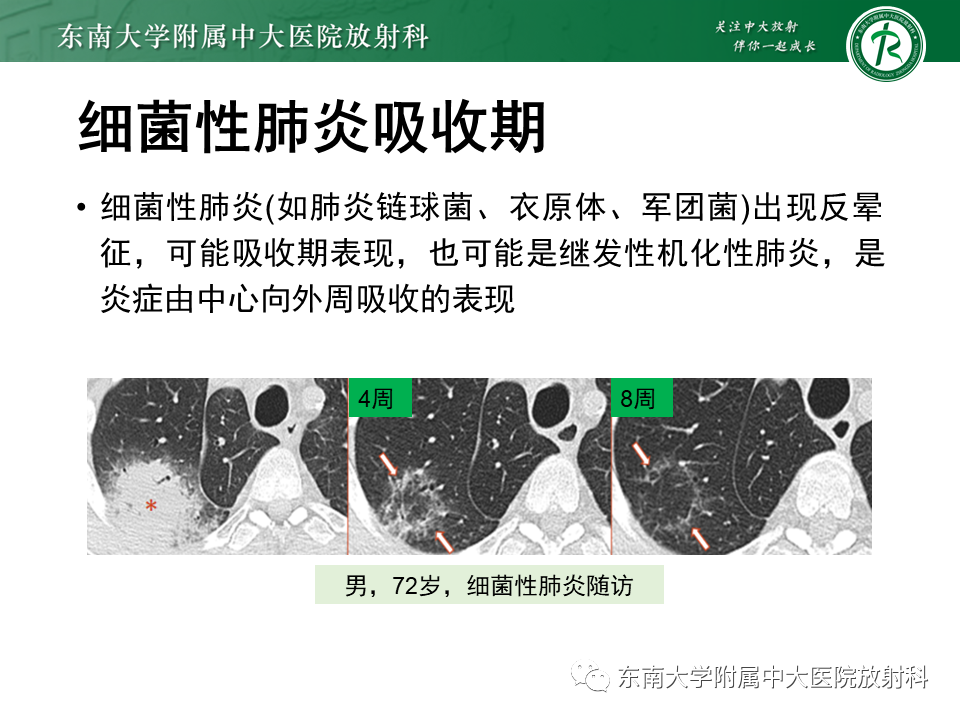影像PPT - 【PPT】“反晕征”相关病变及鉴别-39