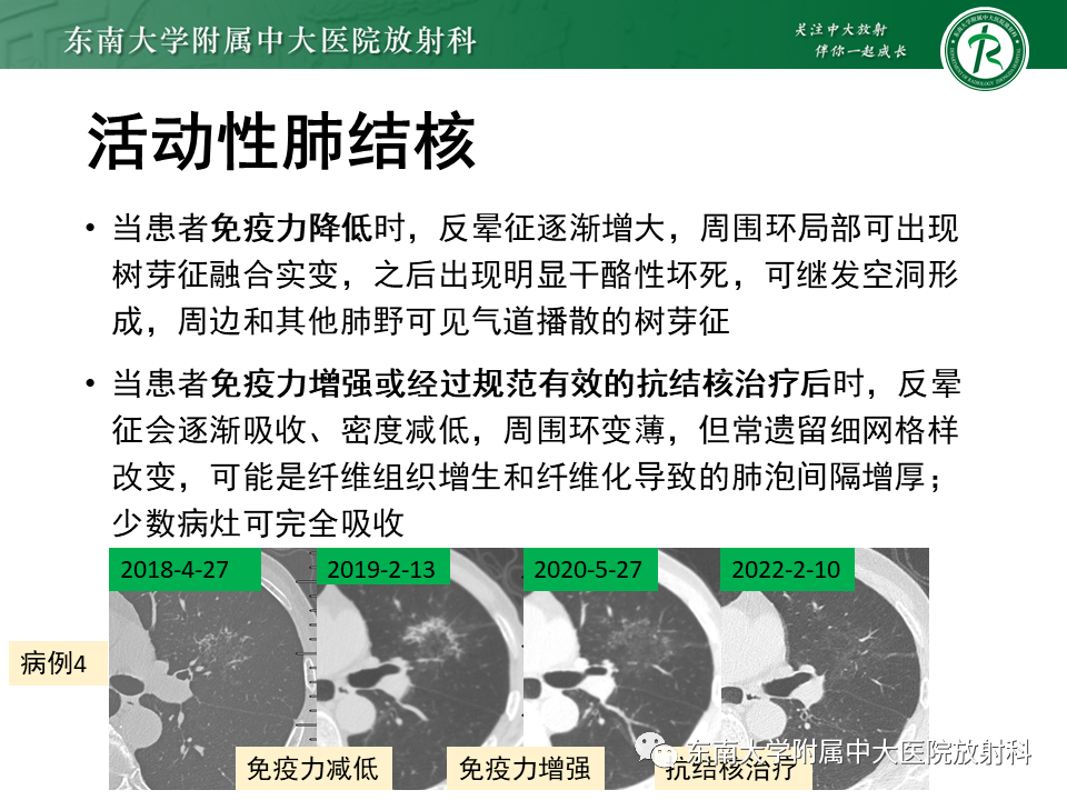 影像PPT - 【PPT】“反晕征”相关病变及鉴别-42