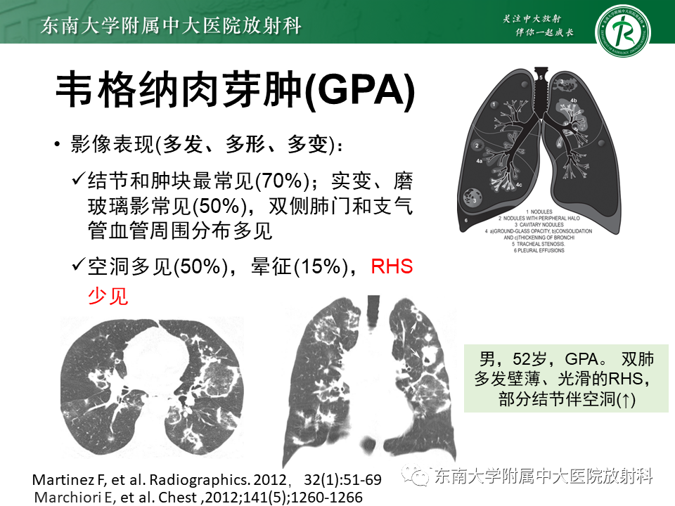 影像PPT - 【PPT】“反晕征”相关病变及鉴别-45