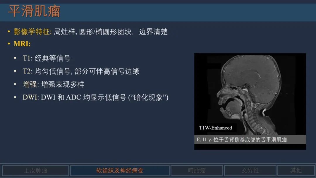 影像PPT - 【PPT】舌良性肿瘤及肿瘤样病变的MR表现及影像与病理对照分析-13 影像PPT - 【PPT】舌良性肿瘤及肿瘤样病变的MR表现及影像与病理对照分析-13
