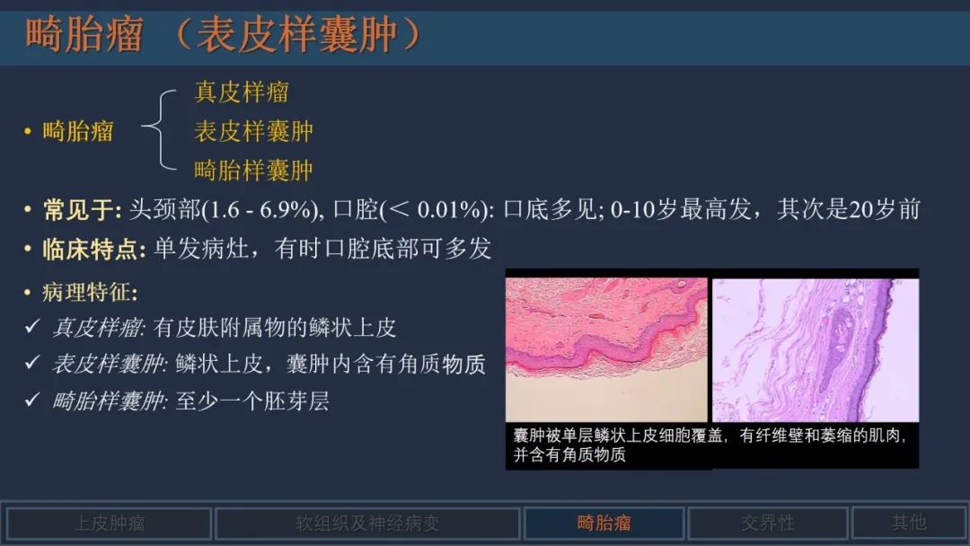影像PPT - 【PPT】舌良性肿瘤及肿瘤样病变的MR表现及影像与病理对照分析-19 影像PPT - 【PPT】舌良性肿瘤及肿瘤样病变的MR表现及影像与病理对照分析-19