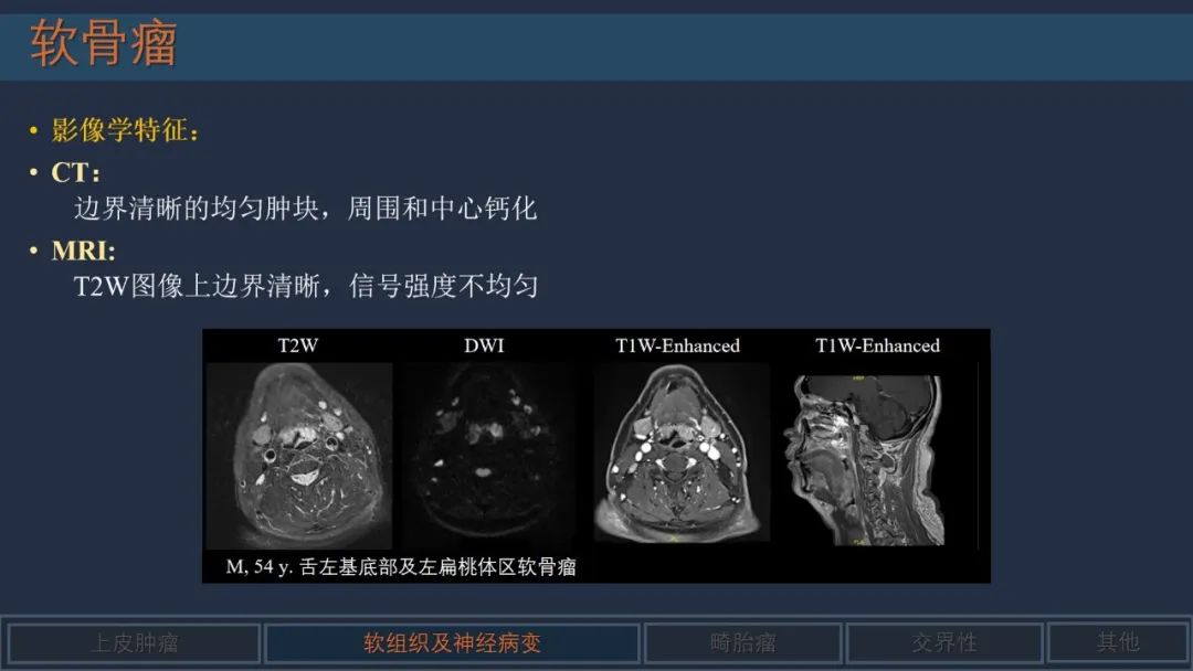 影像PPT - 【PPT】舌良性肿瘤及肿瘤样病变的MR表现及影像与病理对照分析-17 影像PPT - 【PPT】舌良性肿瘤及肿瘤样病变的MR表现及影像与病理对照分析-17