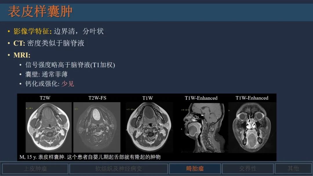影像PPT - 【PPT】舌良性肿瘤及肿瘤样病变的MR表现及影像与病理对照分析-21 影像PPT - 【PPT】舌良性肿瘤及肿瘤样病变的MR表现及影像与病理对照分析-21