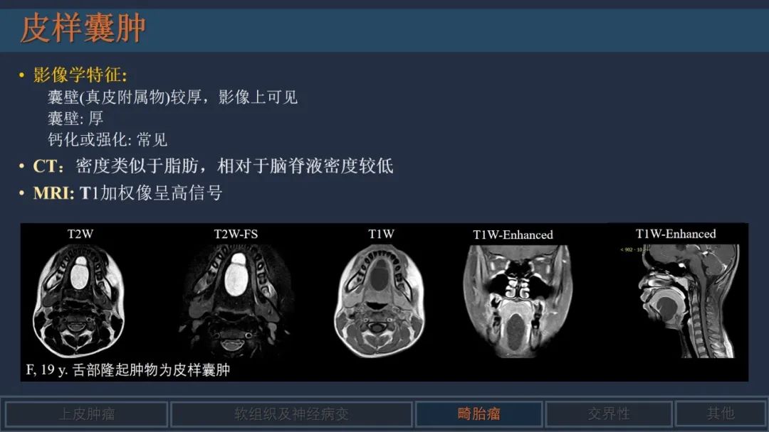 影像PPT - 【PPT】舌良性肿瘤及肿瘤样病变的MR表现及影像与病理对照分析-23 影像PPT - 【PPT】舌良性肿瘤及肿瘤样病变的MR表现及影像与病理对照分析-23