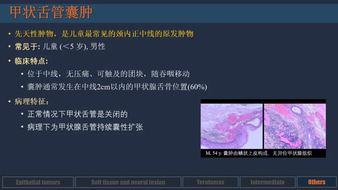 影像PPT - 【PPT】舌良性肿瘤及肿瘤样病变的MR表现及影像与病理对照分析-29 影像PPT - 【PPT】舌良性肿瘤及肿瘤样病变的MR表现及影像与病理对照分析-29