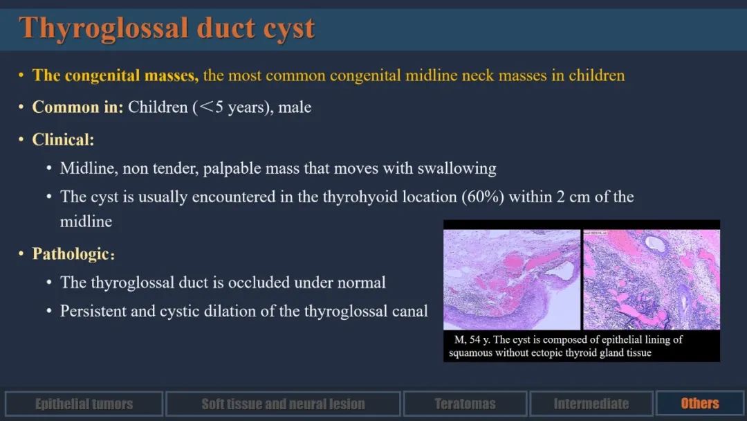 影像PPT - 【PPT】舌良性肿瘤及肿瘤样病变的MR表现及影像与病理对照分析-30 影像PPT - 【PPT】舌良性肿瘤及肿瘤样病变的MR表现及影像与病理对照分析-30