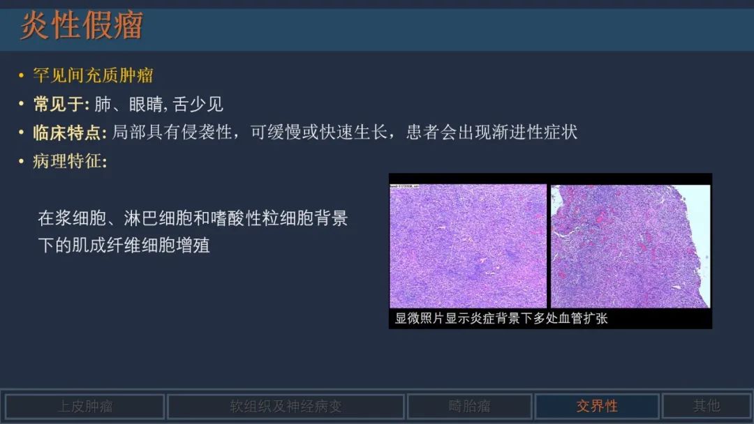 影像PPT - 【PPT】舌良性肿瘤及肿瘤样病变的MR表现及影像与病理对照分析-25 影像PPT - 【PPT】舌良性肿瘤及肿瘤样病变的MR表现及影像与病理对照分析-25