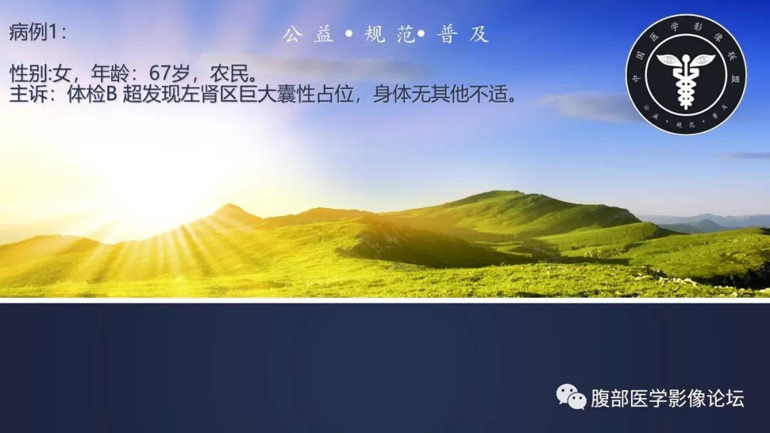 影像PPT - 【病例】肾脏囊肿1例CT影像-2