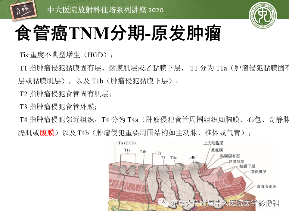 影像PPT - 【PPT】食管癌影像-临床分期-16