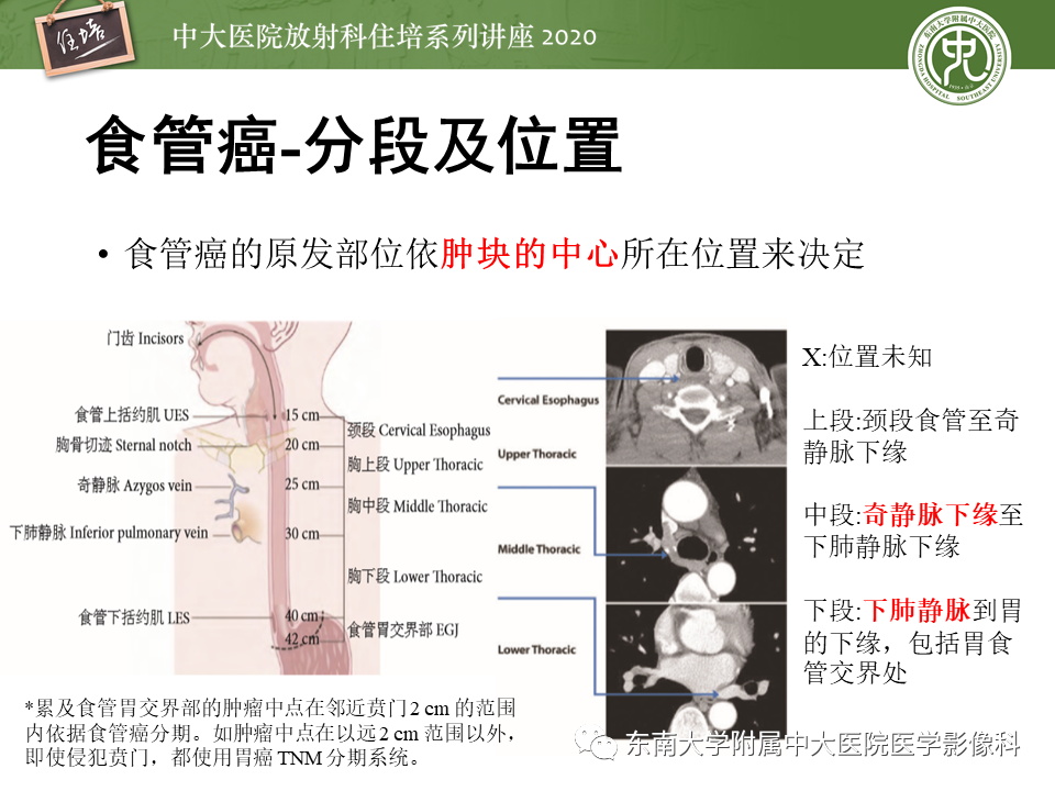 影像PPT - 【PPT】食管癌影像-临床分期-13