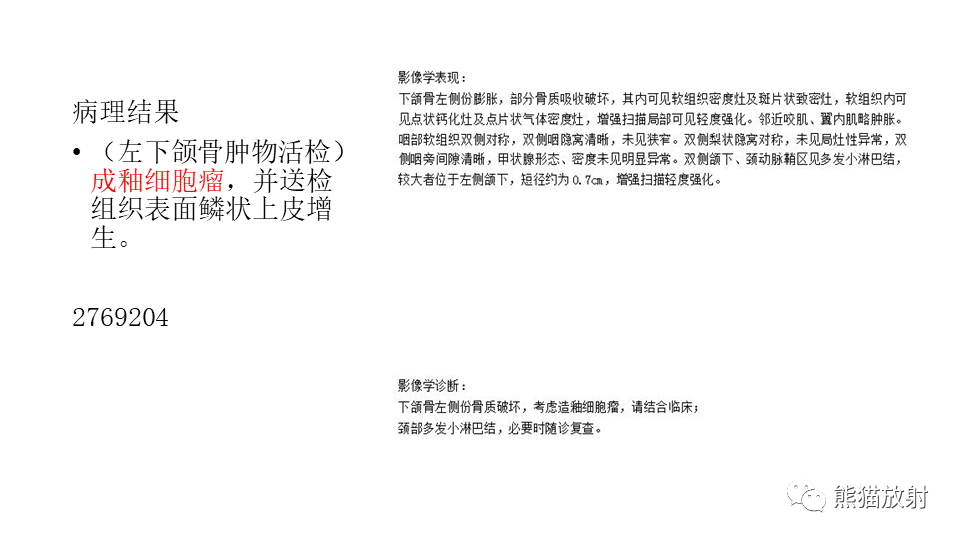 影像PPT - 【病例】下颌骨成釉细胞瘤2例CT-19