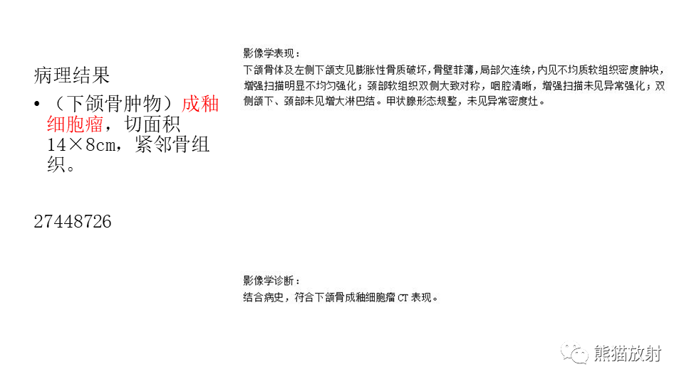 影像PPT - 【病例】下颌骨成釉细胞瘤2例CT-18