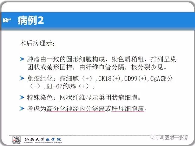 影像PPT - 【PPT】肝脏占位性病变再学习、分析与体会-16