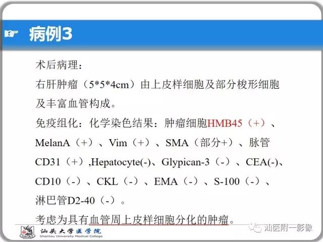 影像PPT - 【PPT】肝脏占位性病变再学习、分析与体会-24