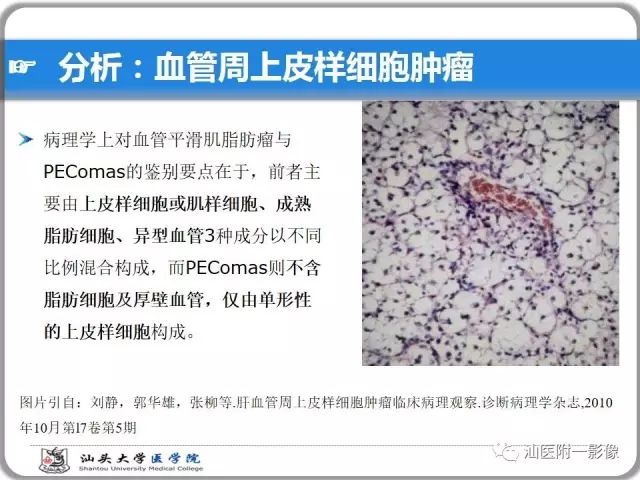 影像PPT - 【PPT】肝脏占位性病变再学习、分析与体会-26