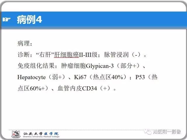 影像PPT - 【PPT】肝脏占位性病变再学习、分析与体会-32