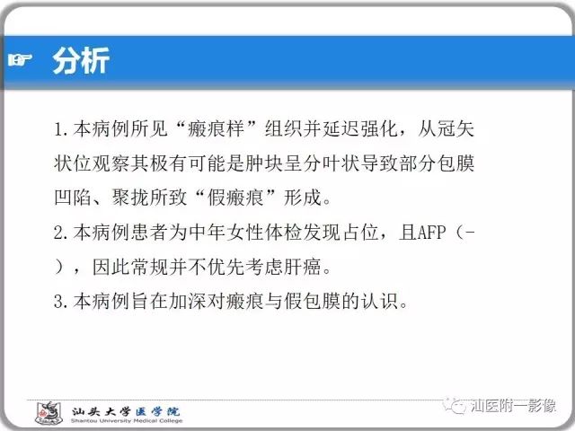 影像PPT - 【PPT】肝脏占位性病变再学习、分析与体会-33