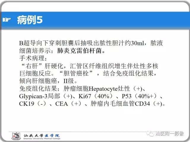 影像PPT - 【PPT】肝脏占位性病变再学习、分析与体会-40