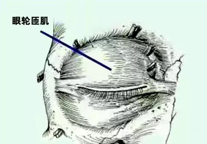 影像PPT - 眼肌及其支配的神经-5 影像PPT - 眼肌及其支配的神经-5