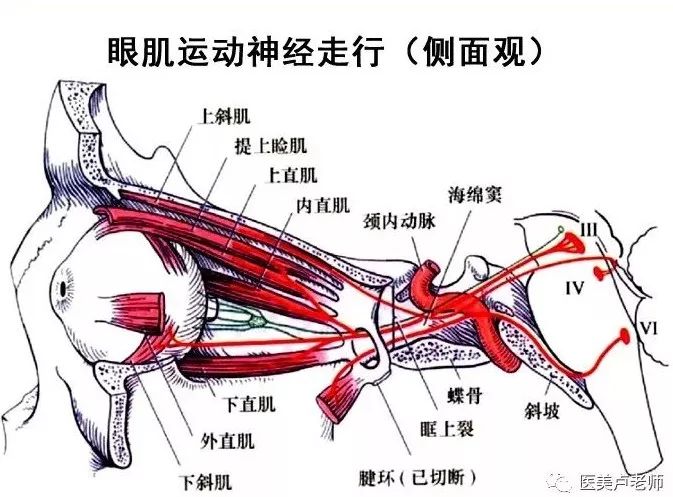 影像PPT - 眼肌及其支配的神经-15 影像PPT - 眼肌及其支配的神经-15