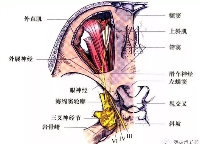 影像PPT - 眼肌及其支配的神经-16 影像PPT - 眼肌及其支配的神经-16