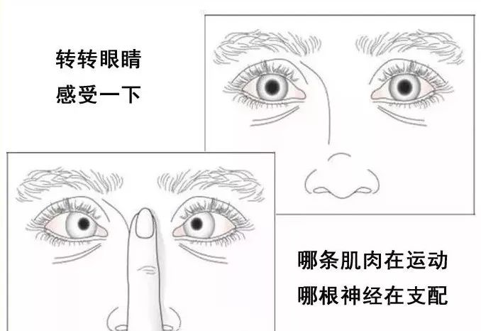 影像PPT - 眼肌及其支配的神经-25 影像PPT - 眼肌及其支配的神经-25