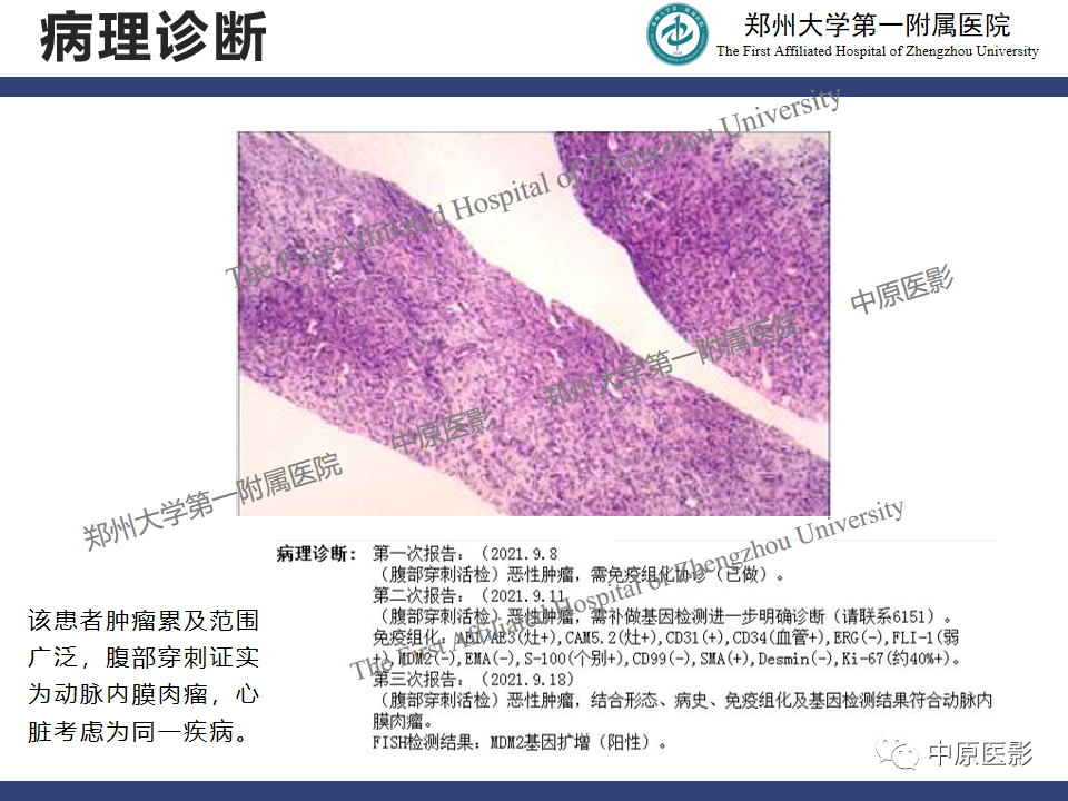 影像PPT - 【病例】心脏肉瘤1例MR影像-9