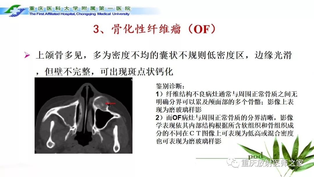 影像PPT - 【PPT】颌骨常见肿瘤及肿瘤样病变的CT诊断及鉴别诊断-47