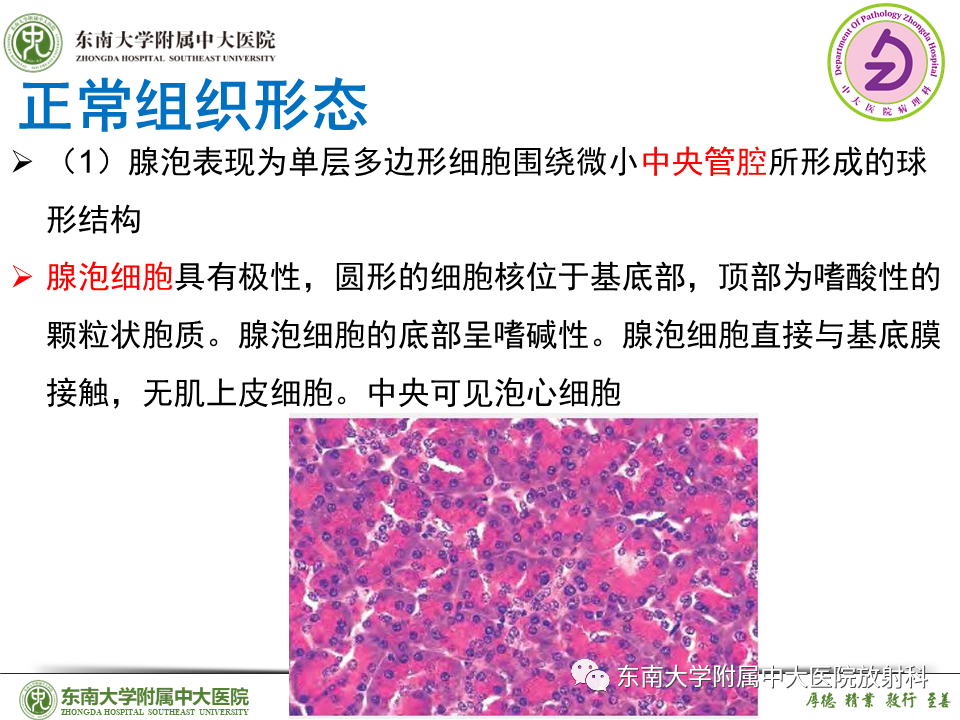 影像PPT - 【PPT】胰腺癌鉴别诊断-26 影像PPT - 【PPT】胰腺癌鉴别诊断-26