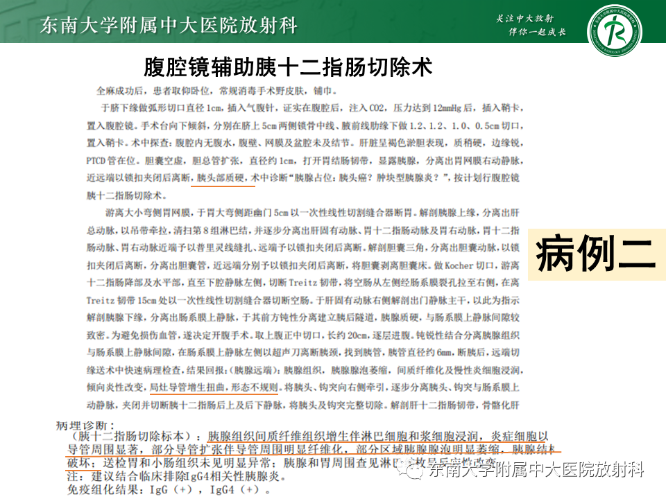 影像PPT - 【PPT】胰腺癌鉴别诊断-1 影像PPT - 【PPT】胰腺癌鉴别诊断-1