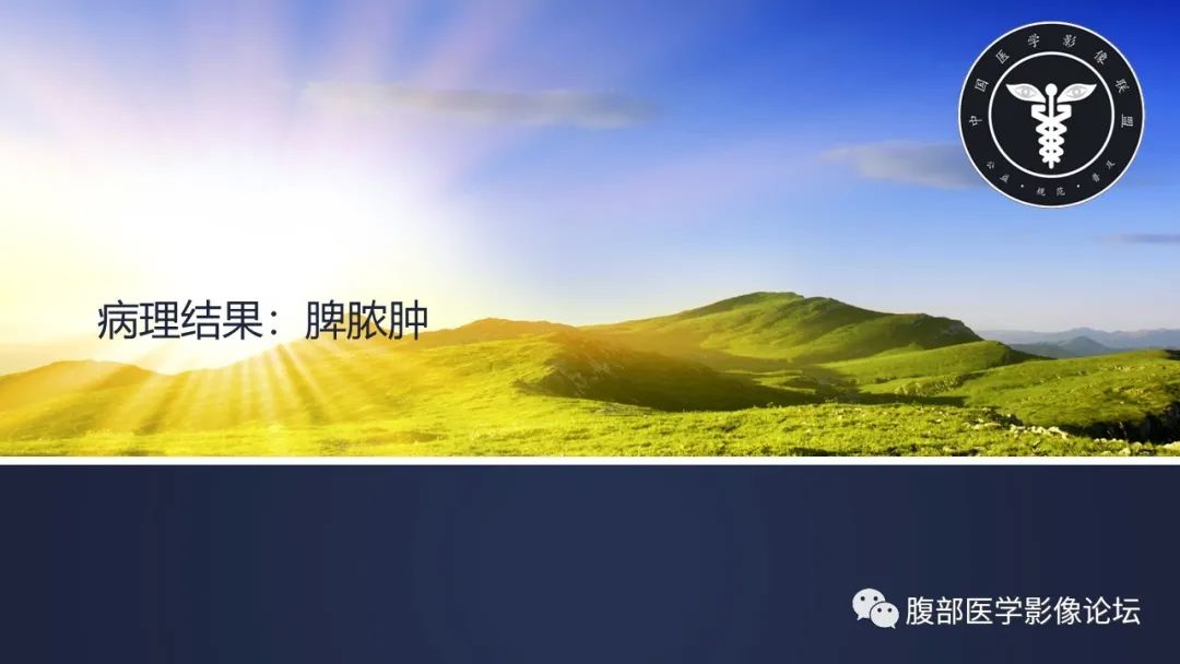 影像PPT - 【病例】脾脏脓肿1例CT影像-11 影像PPT - 【病例】脾脏脓肿1例CT影像-11