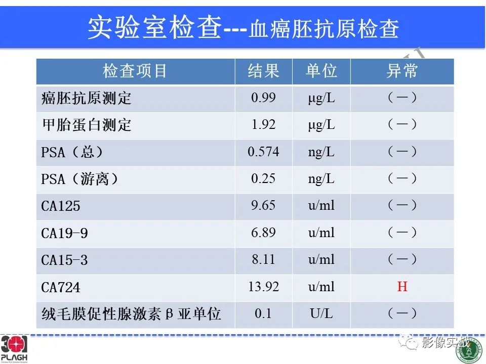 影像PPT - 【病例】中枢神经系统生殖细胞肿瘤1例MR-5