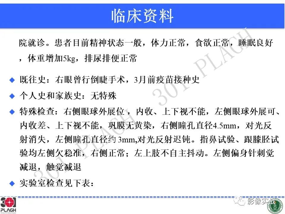 影像PPT - 【病例】中枢神经系统生殖细胞肿瘤1例MR-3