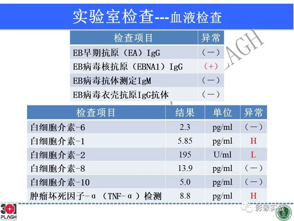 影像PPT - 【病例】中枢神经系统生殖细胞肿瘤1例MR-7