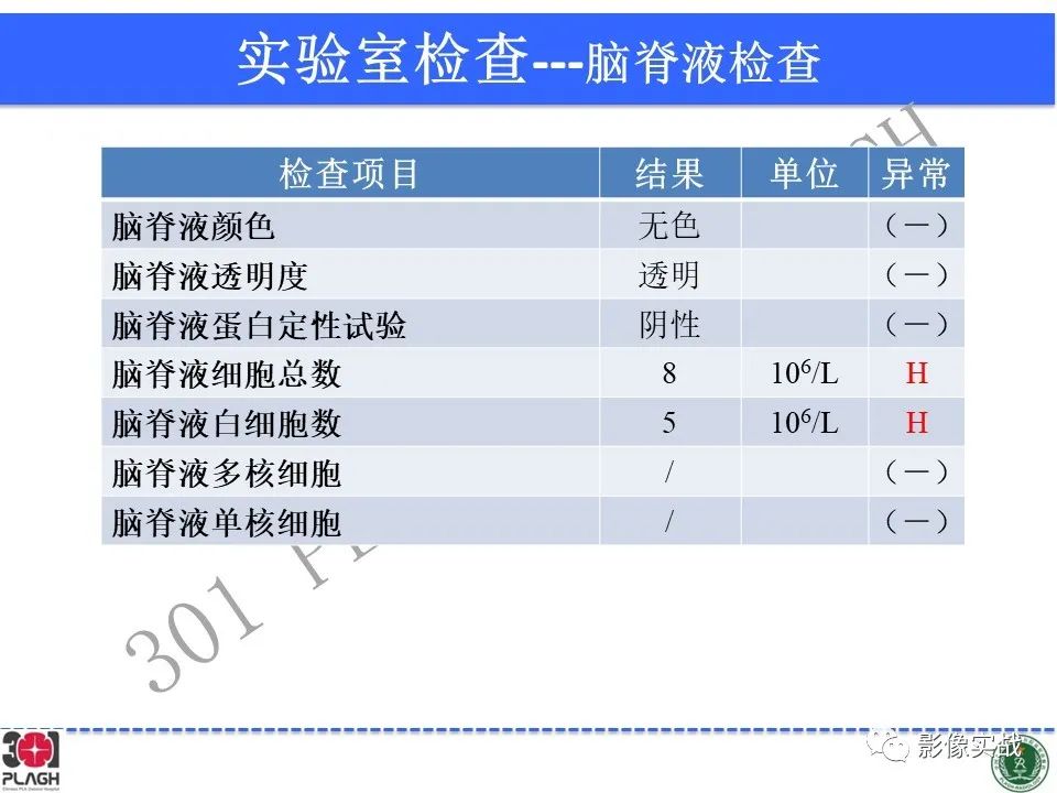 影像PPT - 【病例】中枢神经系统生殖细胞肿瘤1例MR-9
