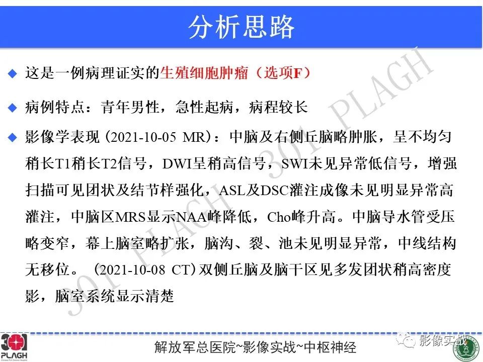 影像PPT - 【病例】中枢神经系统生殖细胞肿瘤1例MR-28