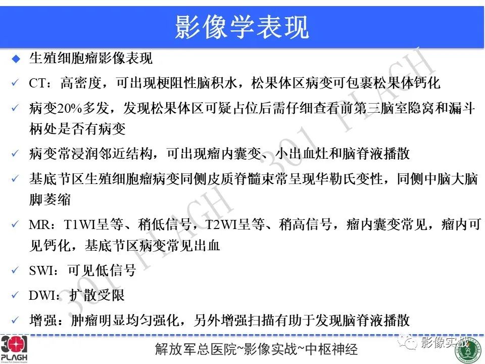 影像PPT - 【病例】中枢神经系统生殖细胞肿瘤1例MR-36