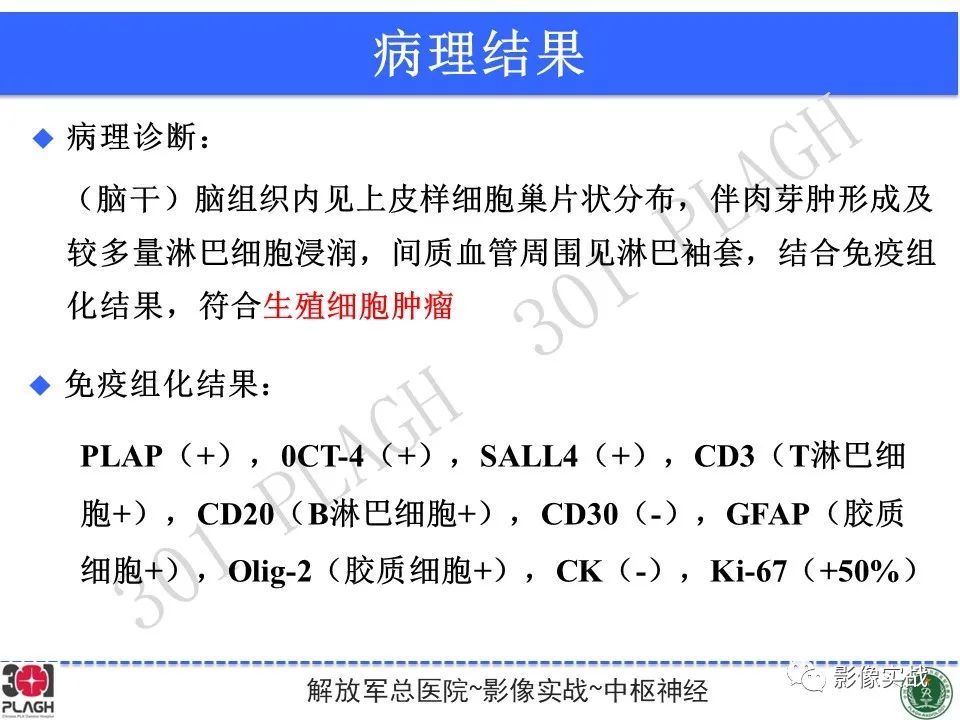 影像PPT - 【病例】中枢神经系统生殖细胞肿瘤1例MR-33