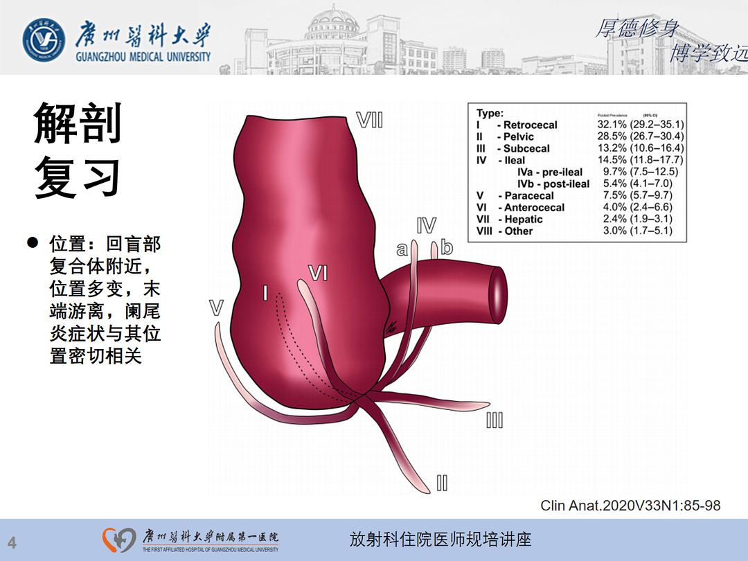 影像PPT - 【PPT】急性阑尾炎影像诊断思考和综述-5