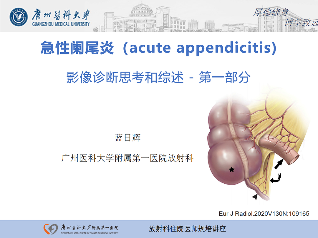 影像PPT - 【PPT】急性阑尾炎影像诊断思考和综述-1